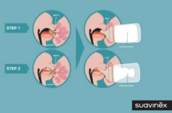 Suavinex Zero.Zero Anti-Colic Slow Flow Zuigfles 180ml SXZBRF051118 -Baby Producten Winkel suavinex zer .zer anti colic zuigfles 3 1